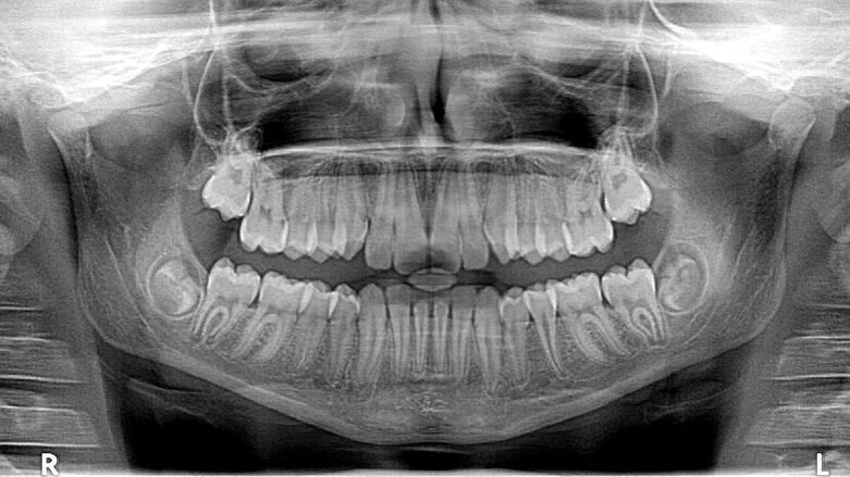Groen licht voor taakherschikkingsexperiment