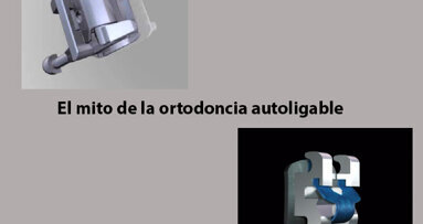 Conferencia online sobre ortodoncia autoligable