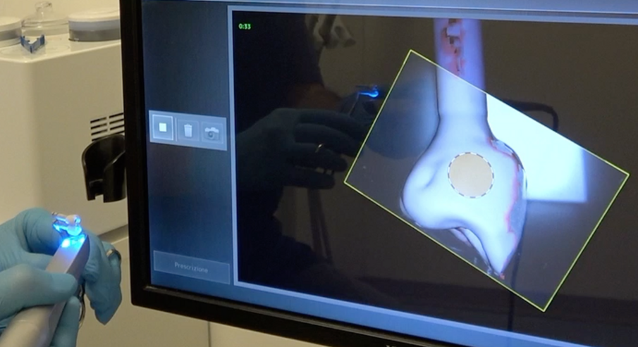 Fig. 5_Acquisizione extraorale della forma del provvisorio collegato agli analoghi da laboratorio.