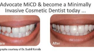 Prihvatite trend (MiCD Minimalno invazivna estetska stomatologija)