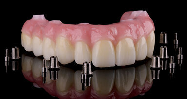 Titanové báze – nové možnosti osvědčených mezostruktur