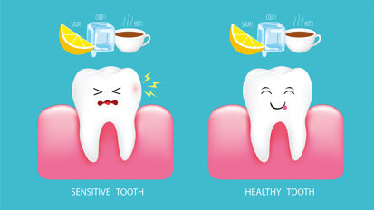 Shining the brightest light on sensitive teeth