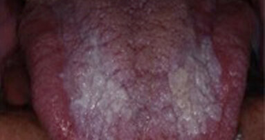 Un’App gratuita per aiutare a orientarsi nella diagnosi morfologica delle lesioni del cavo orale