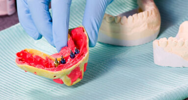 Comitê FDA confirma a queda na classificação dos implantes dentários