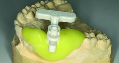 Traitement en une seule visite grâce à la CFAO et la CBCT