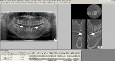 J. Morita USA partners with TDO