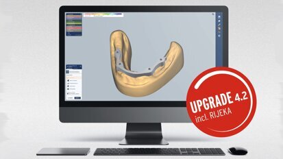 El mecanizado de restauraciones llega a un nuevo nivel