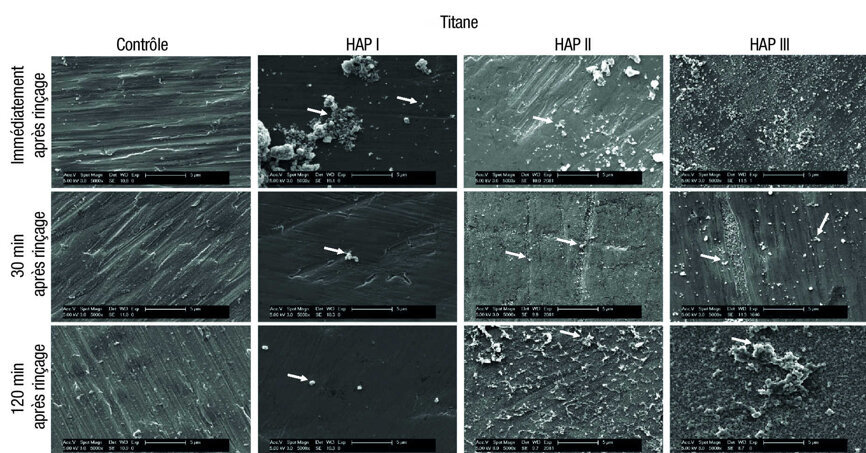 Fig 6 : Micrographies MEB de la pellicule sous un grossissement de 5 000 fois et les nano-HAP sur les échantillons de titane. La formation de la pellicule et les particules d’hydroxyapatite sont visibles à trois moments d’évaluation différents : immédiatement après l’utilisation de la solution de rinçage à base de HAP I, HAP II, et HAP III a 5 %, puis 30 minutes et deux heures après. Les flèches blanches indiquent les HAP accumulées sur la surface de titane.