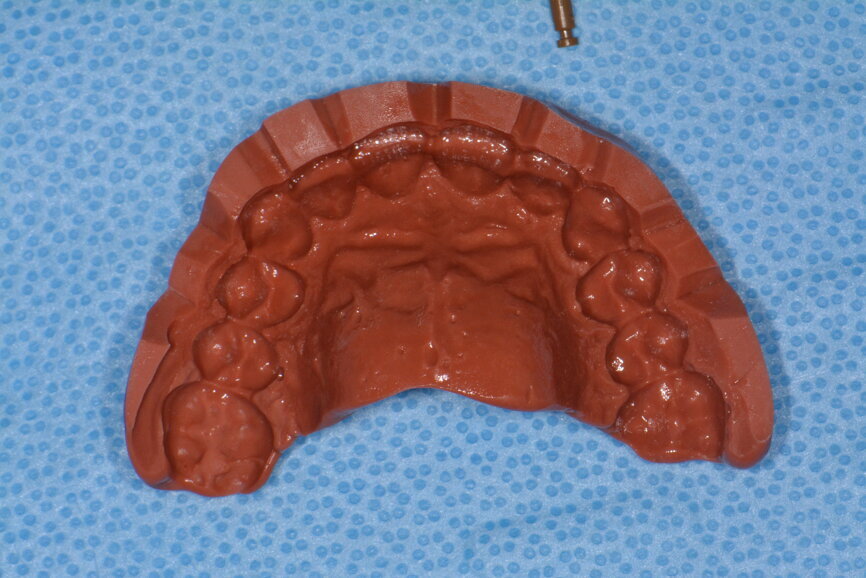 Fig. 16: Putty jig made on the printed model for the mock-up.