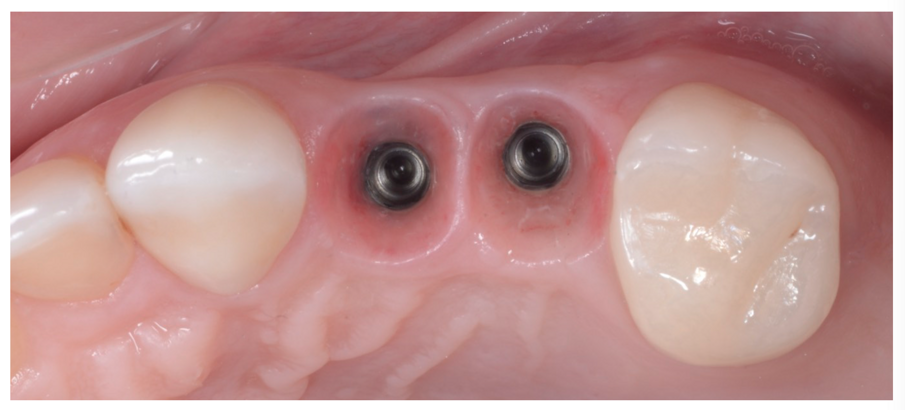 Fig. 1_Tessuti condizionati dal provvisorio.