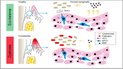 Study identifies cells in gingivae that protect against periodontitis Study identifies cells in gingivae that protect against periodontitis