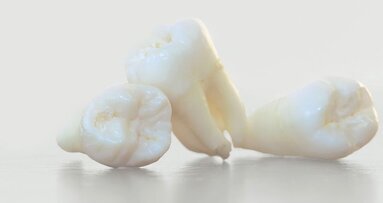 Oplossing voor het tandartstekort in China? De behandelrobot