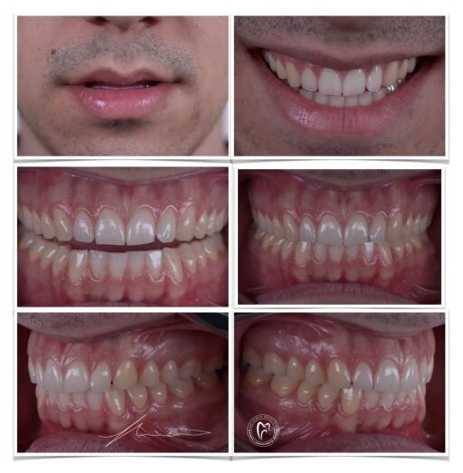 Slika 1b: Radne fotografije (Zahvalnost dr Milošu Ljubičiću na fotografijama i dr Lazaru Terziću kao modelu)