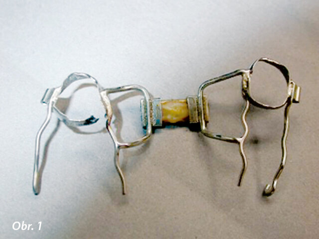 Poškozený aparát po vyjmutí z úst