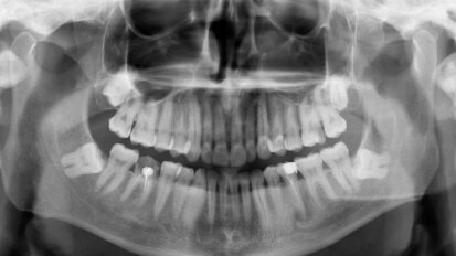On the pulse of endodontics—the key role of new technologies in root canal therapy