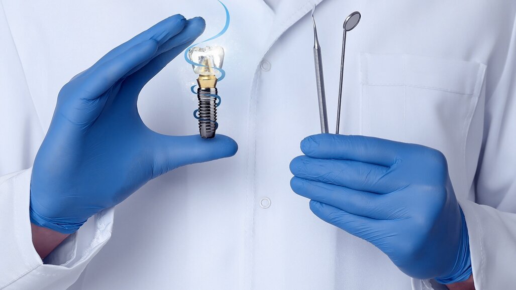 Digital workflows for conversion prostheses in full-arch implant dentistry