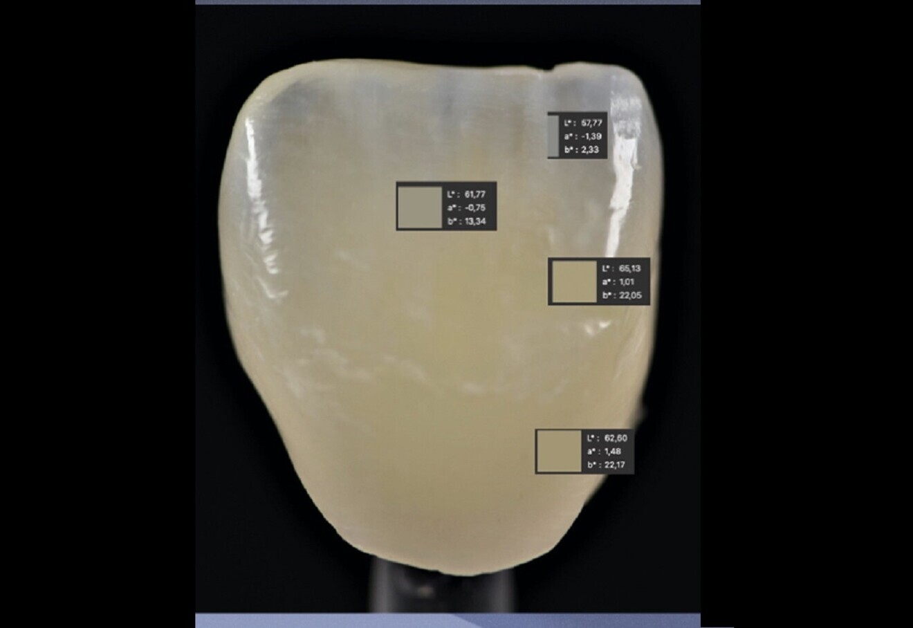 Fig. 15: Final CIELAB colour space check of a prosthesis.