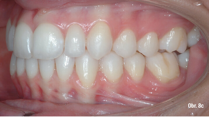 Kazuistika - popis v textu