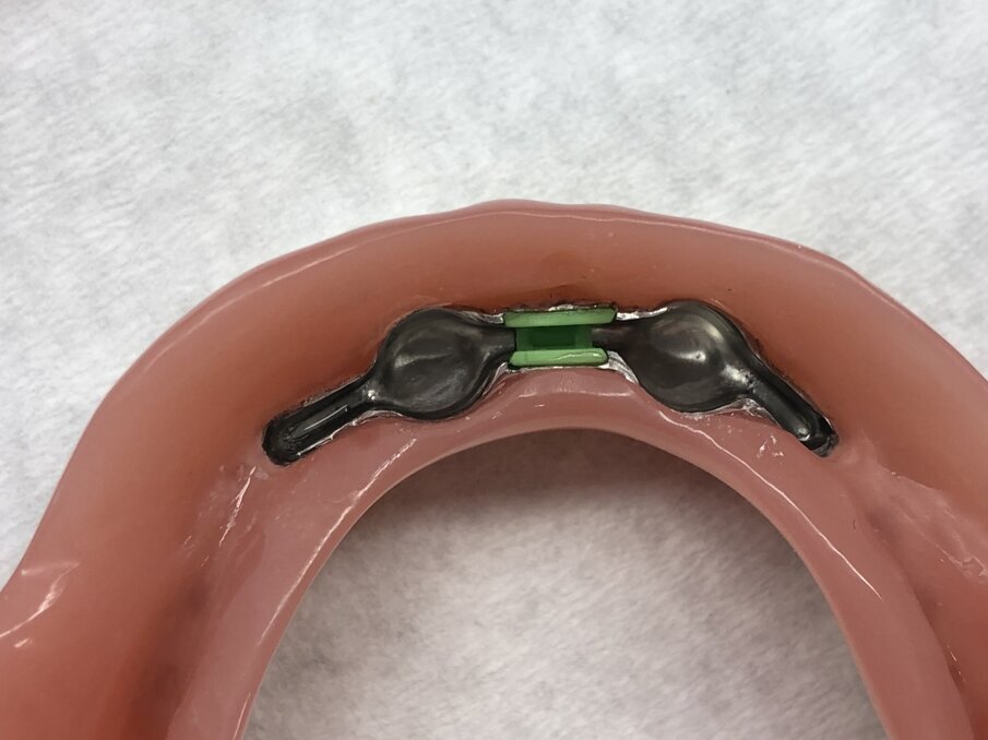 Afbeelding 10. Situatie van kunststof deel in de staaf.