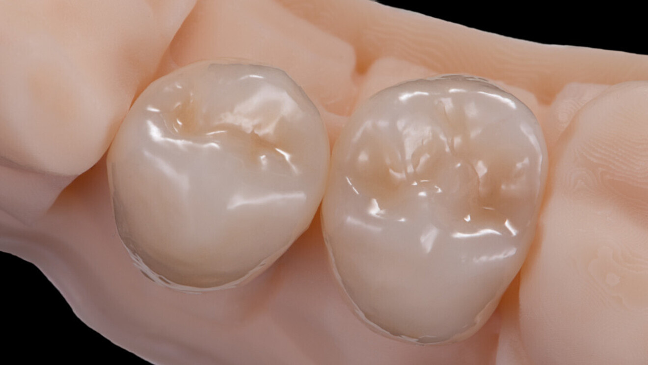 Fig. 15: Harmonious naturalness and a radiantly warm liveliness from the inside out, achieved in a very short production time.