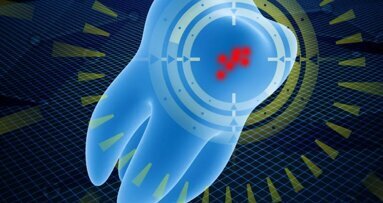 Късовълновите инфрачервени лъчи крият потенциал за откриване на вторични кариозни лезии