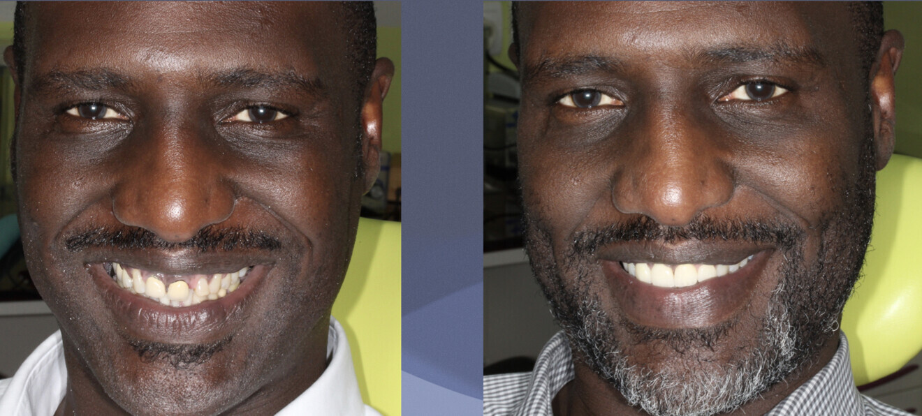 Fig. 16: Satisfied patient, the result of good collaboration between the laboratory and dental office (Drs Christian Moussally and Ty Vallée).