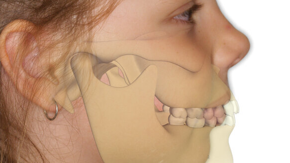 The nose knows: A big-picture look at myofunctional orthodontics