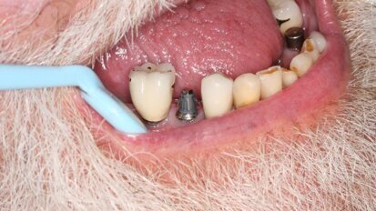 士卓曼购得美RODO Medical公司12%的股份