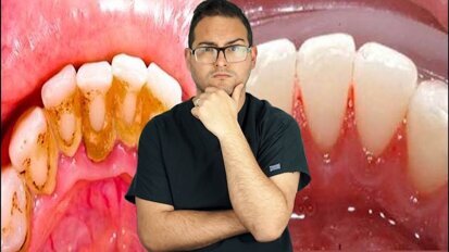 El dentista más popular (3)