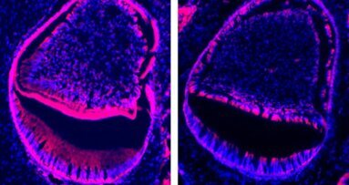 Une découverte génétique pourrait mener à des progrès dans les traitements dentaires