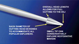 La preparación del perímetro