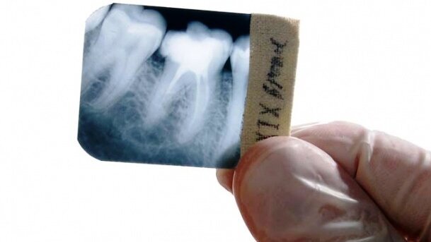 Carestream Health podwyższa ceny filmów do badań radiologicznych