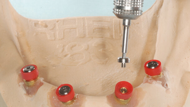 Ot Cap normo-micro e Ot Equator. Attacchi a sfera filettati intercambiabili con guaina da incollare