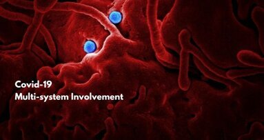 COVID-19: Beyond a respiratory illness. A Multi-system Inflammatory Syndrome (MIS)- Amisha Parekh