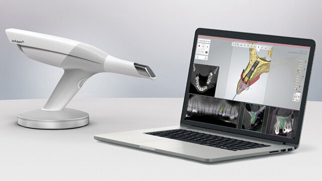 Sólo implantát: Náhrada horního premoláru pomocí digitálního pracovního postupu