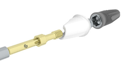 Neoss Implant System