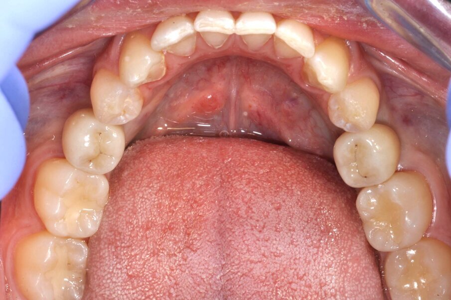 Fig. 18_Restauri defintivi.