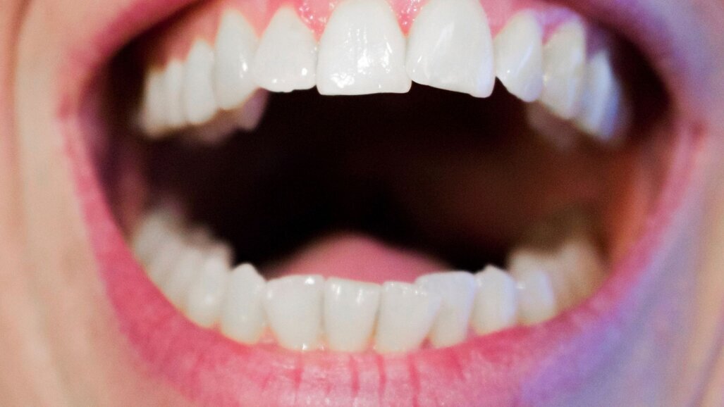 Botox A for OSMF: a novel therapeutic approach