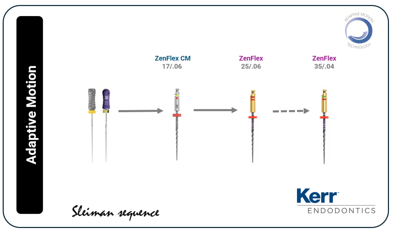 Fig. 3: ZenFlex CM file sequence in Adaptive Motion.