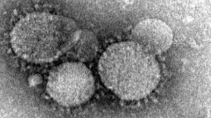 אגוד לבקרת זיהומים מעדכן את רופאי השיניים בנושא מחלות זיהומיות