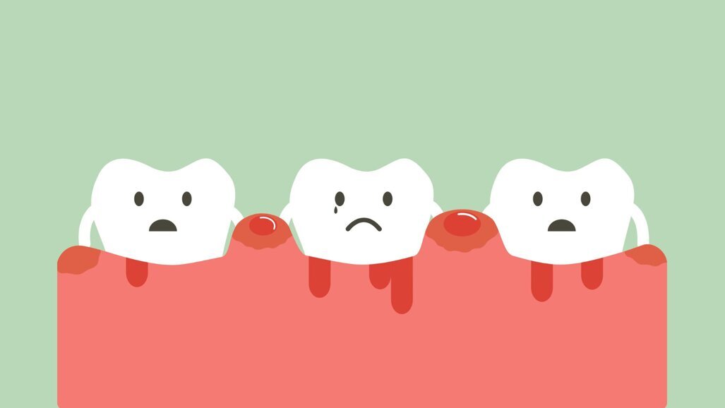 Hypermobiliteit steeds meer erkend als probleem