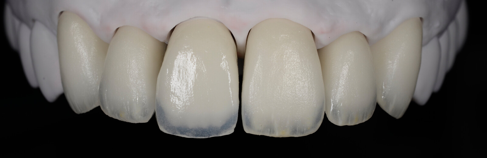Fig. 20: Result after completion of the internal staining procedure.