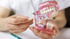 Geistlich webinar to explore AI and precision approaches in implant dentistry