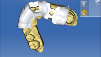 À l’aube de l’intelligence artificielle, comment tirer profit de la technologie pour garder la main sur nos traitements