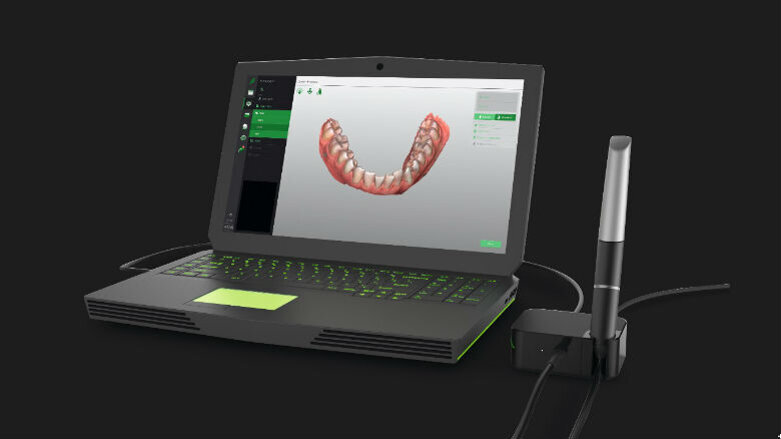 Virtuo Vivo™ Intraoral Scanner: l’inizio di una nuova era digitale