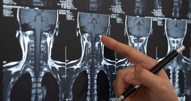 Back scatter: Understanding the implications of radiotherapy for dental implants in head and neck cancer patients