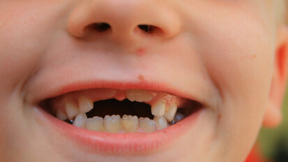 AGD calls for cooperation in improving care for children AGD calls for cooperation in improving care for children