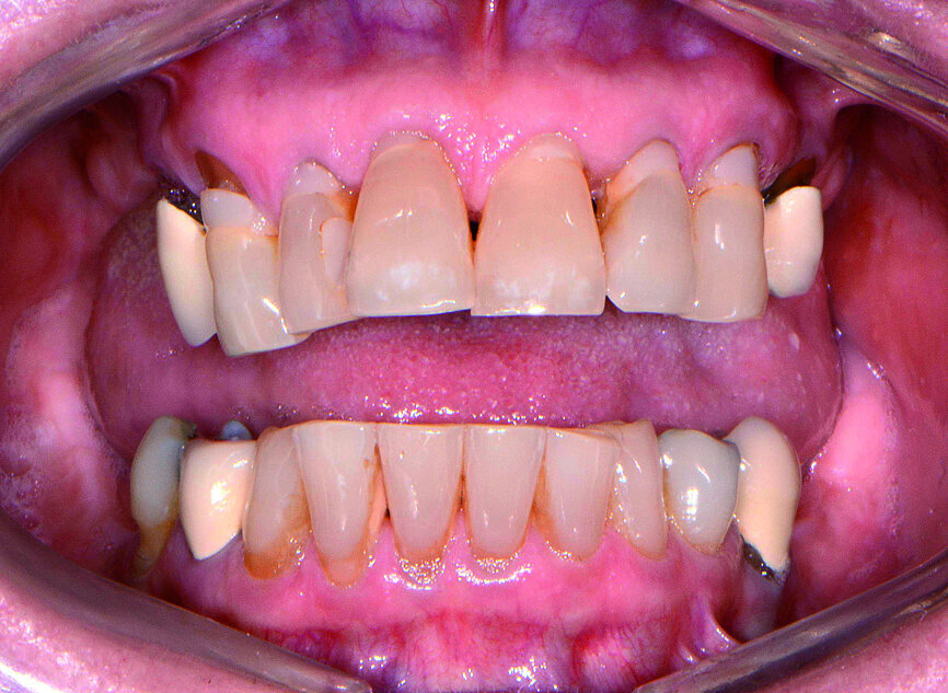 Fig. 1: Retracted preoperative view.
