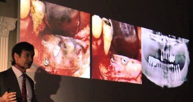 „Kierunki dla implantologii i inżynierii tkankowej” – 12. Kongres OSIS