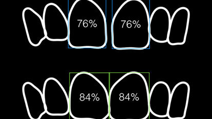 Figura 2. Proporciones reales e ideales de los incisivos centrales.